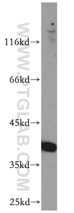 RP2 Antibody in Western Blot (WB)