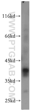 RP2 Antibody in Western Blot (WB)