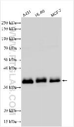 SLA2 Antibody in Western Blot (WB)