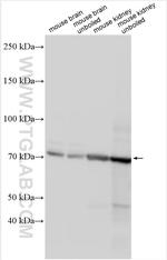 SLC26A11 Antibody in Western Blot (WB)