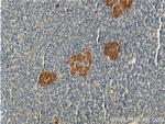 KRAP/SSFA2 Antibody in Immunohistochemistry (Paraffin) (IHC (P))