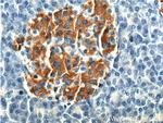 KRAP/SSFA2 Antibody in Immunohistochemistry (Paraffin) (IHC (P))