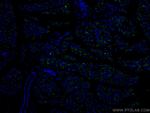 KRAP/SSFA2 Antibody in Immunohistochemistry (PFA fixed) (IHC (PFA))