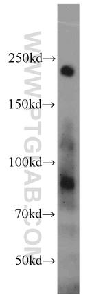 KRAP/SSFA2 Antibody in Western Blot (WB)
