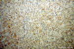 MIPOL1 Antibody in Immunohistochemistry (Paraffin) (IHC (P))