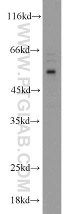 MIPOL1 Antibody in Western Blot (WB)