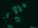 SLC25A45 Antibody in Immunocytochemistry (ICC/IF)