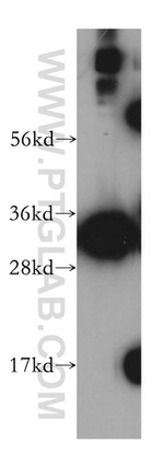 SLC25A45 Antibody in Western Blot (WB)
