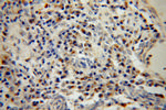 BET1L Antibody in Immunohistochemistry (Paraffin) (IHC (P))