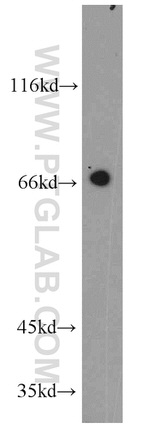 PTH2R Antibody in Western Blot (WB)