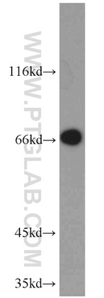 PTH2R Antibody in Western Blot (WB)