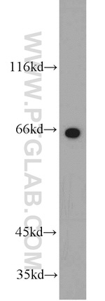 PTH2R Antibody in Western Blot (WB)