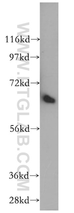 PTH2R Antibody in Western Blot (WB)