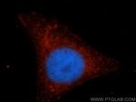 IRF9 Antibody in Immunocytochemistry (ICC/IF)