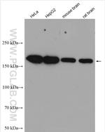 UGCGL1 Antibody in Western Blot (WB)