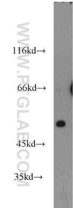 Secretin receptor Antibody in Western Blot (WB)