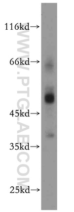 Secretin receptor Antibody in Western Blot (WB)