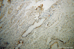 CHD4 Antibody in Immunohistochemistry (Paraffin) (IHC (P))