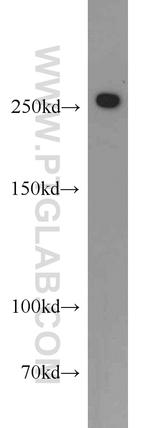 CHD4 Antibody in Western Blot (WB)