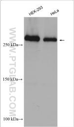 CHD4 Antibody in Western Blot (WB)