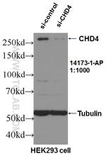 CHD4 Antibody in Western Blot (WB)