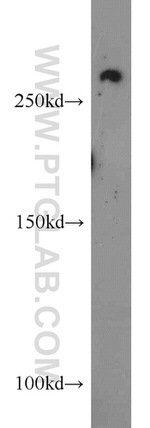 CHD4 Antibody in Western Blot (WB)