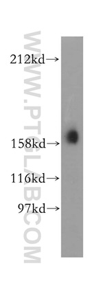 Liprin alpha 1 Antibody in Western Blot (WB)