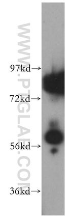 GK3P Antibody in Western Blot (WB)