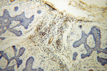 GK3P Antibody in Immunohistochemistry (Paraffin) (IHC (P))
