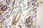 GK3P Antibody in Immunohistochemistry (Paraffin) (IHC (P))