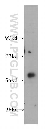 GK3P Antibody in Western Blot (WB)