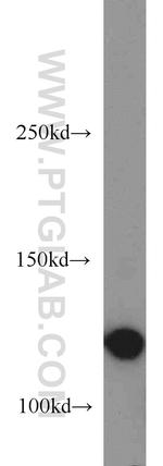 SMC5 Antibody in Western Blot (WB)