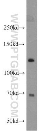 SMC5 Antibody in Western Blot (WB)