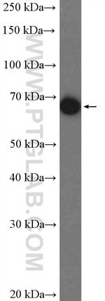 alpha-1B-glycoprotein Antibody in Western Blot (WB)
