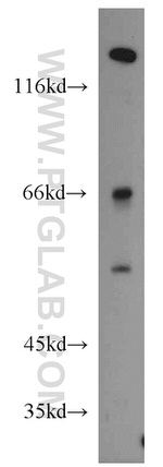 alpha-1B-glycoprotein Antibody in Western Blot (WB)