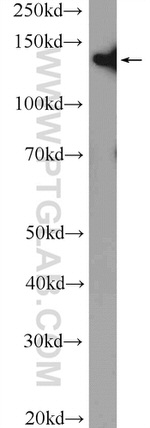 SMC3 Antibody in Western Blot (WB)