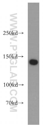 SMC3 Antibody in Western Blot (WB)