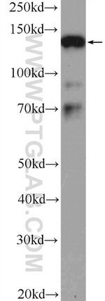 SMC3 Antibody in Western Blot (WB)