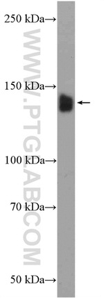 SMC3 Antibody in Western Blot (WB)