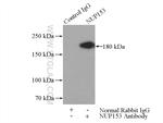 NUP153 Antibody in Immunoprecipitation (IP)