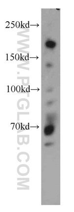 NUP153 Antibody in Western Blot (WB)