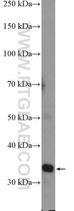 PPP1R3B Antibody in Western Blot (WB)