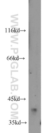 HSD11B2 Antibody in Western Blot (WB)