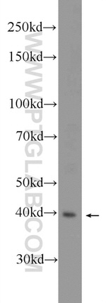 HSD11B2 Antibody in Western Blot (WB)