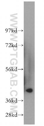 HSD11B2 Antibody in Western Blot (WB)