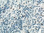 TNFSF14 Antibody in Immunohistochemistry (Paraffin) (IHC (P))