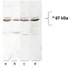 CAT-1 Antibody in Western Blot (WB)