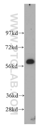 CREB5 Antibody in Western Blot (WB)