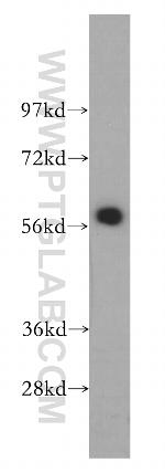 CREB5 Antibody in Western Blot (WB)