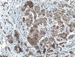 TNK1 Antibody in Immunohistochemistry (Paraffin) (IHC (P))
